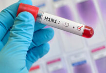 കുവൈറ്റിൽ പന്നിപ്പനി സ്ഥിരീകരിച്ചതായി ആരോഗ്യ മന്ത്രാലയം