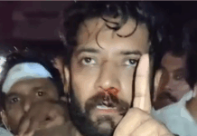 ഷാഫി പറമ്പിൽ എം.പി ക്ക് നേരെയുള്ള പോലീസ് അതിക്രമത്തിൽ ശക്തമായ പ്രതിഷേധം: ഐ.വൈ.സി.സി ബഹ്റൈൻ